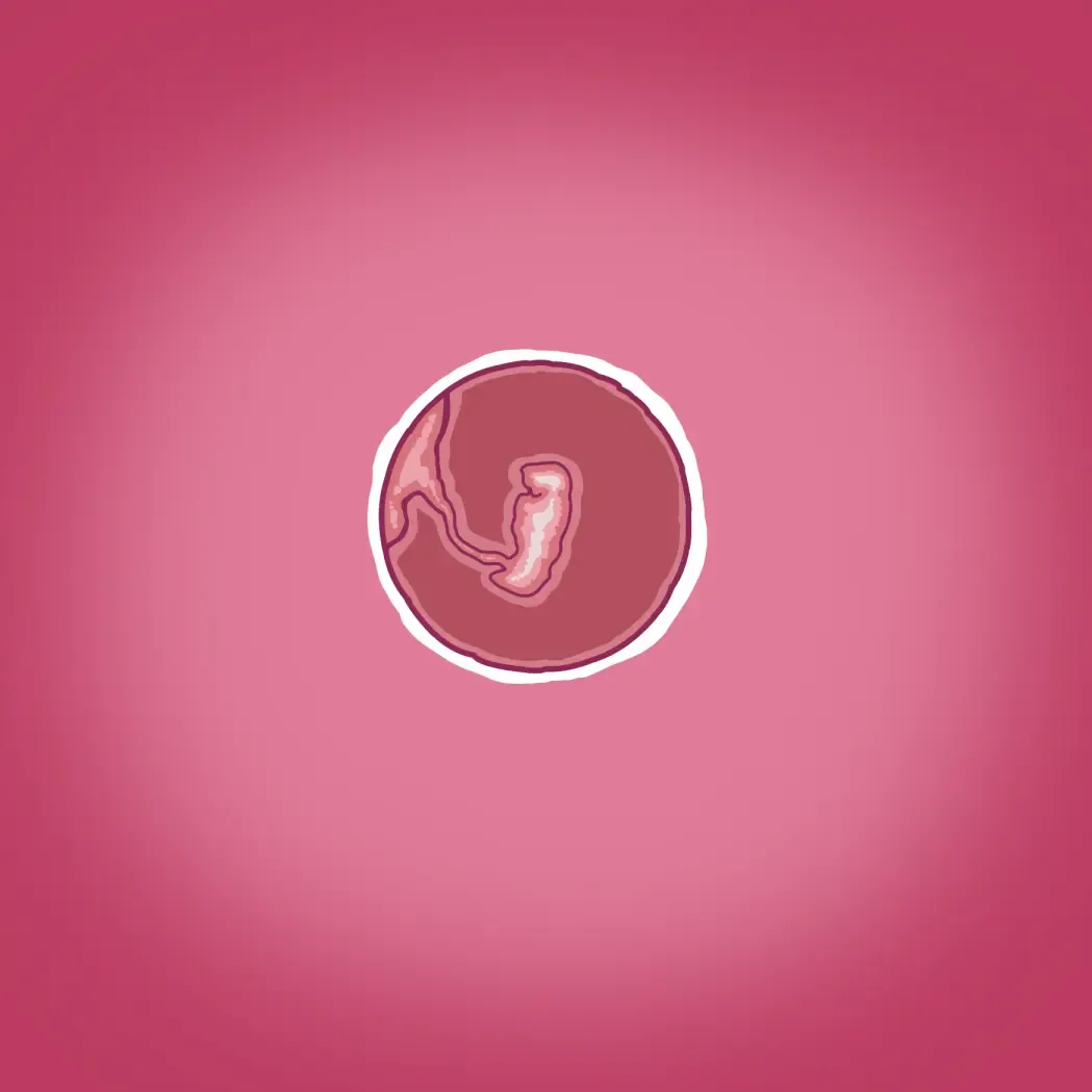 [Straw] Yumi's Study Abroad/由美的留学生活（汉化）（连载中） Fhentai - Page 7