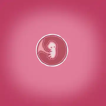 [Straw] Yumi's Study Abroad/由美的留学生活（汉化）（连载中） Fhentai - Page 28