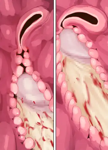 [Bionics Nattou] MINI-DAKU Summer Fhentai - Page 55